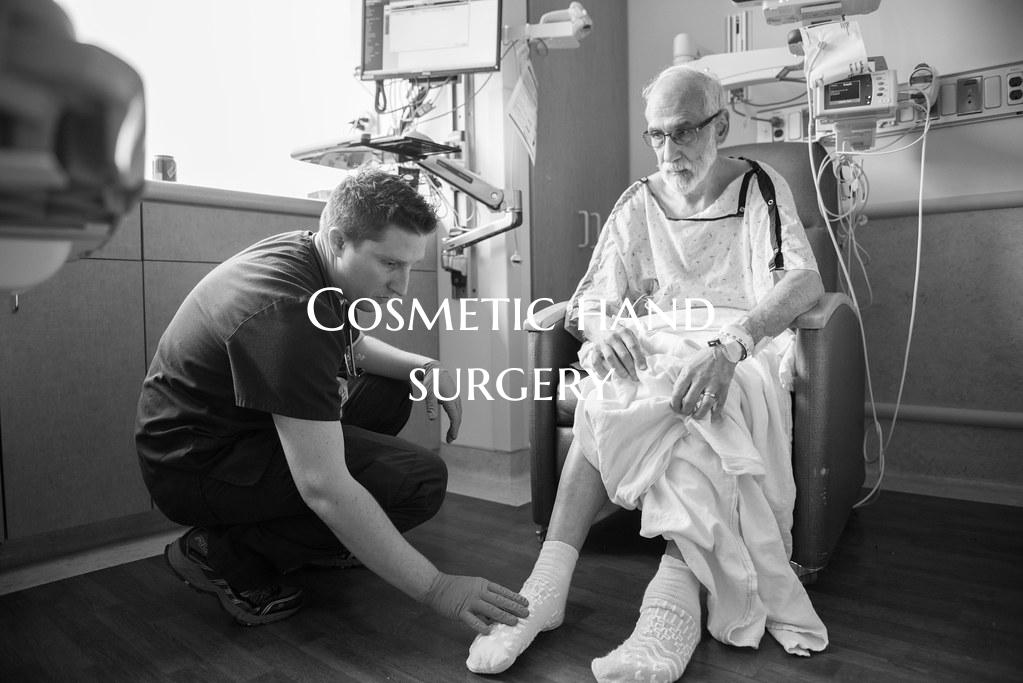 Cosmetic hand surgery